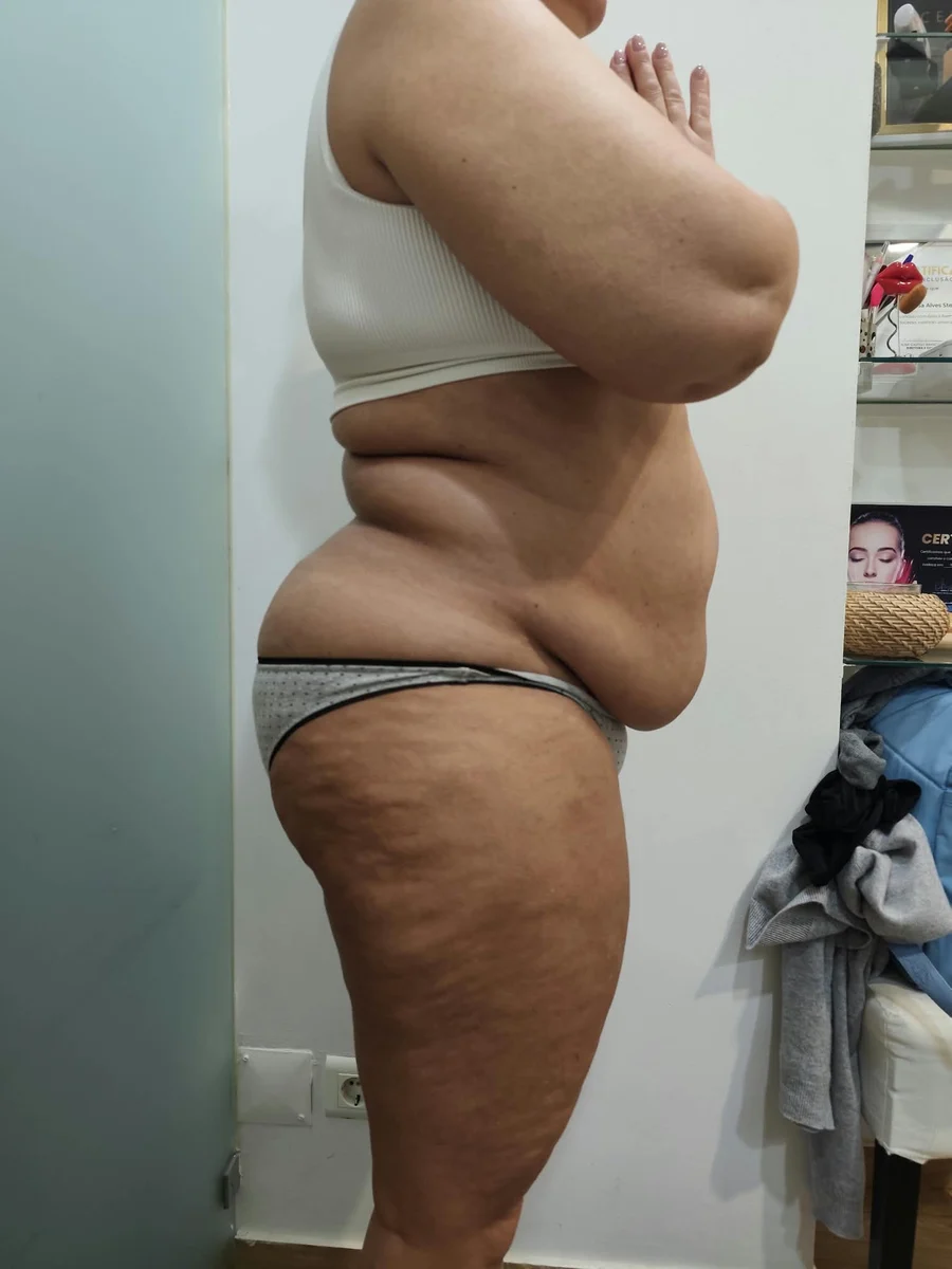 Antes, registo clínico corporal em perfil