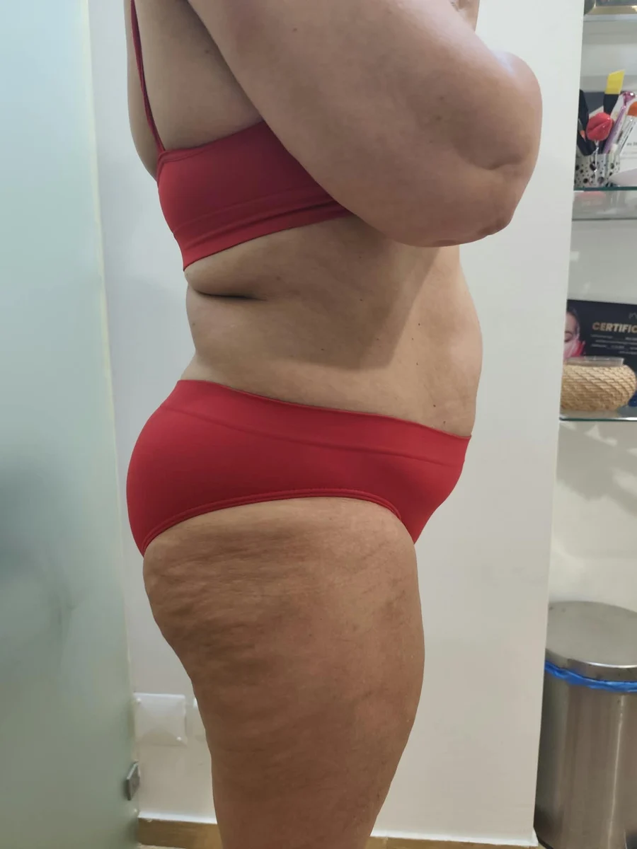 Depois, registo clínico corporal em perfil
