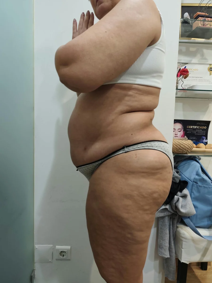 Antes, registo clínico corporal em perfil oposto